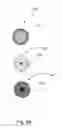 Fig. 74 - Linked bilateral spinal facet implants and methods of use