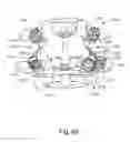 Fig. 75 - Linked bilateral spinal facet implants and methods of use