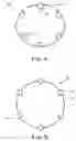 Fig. 04 - Surgical marker/connector and method of installation