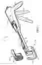 Fig. 03 - Method for performing trans-anal resection with a curved cutter stapler