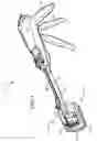 Fig. 04 - Method for performing trans-anal resection with a curved cutter stapler