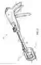Fig. 05 - Method for performing trans-anal resection with a curved cutter stapler