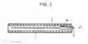 Fig. 02 - Method of securing acupuncture needle to insertion tube and acupuncture needle with insertion tube