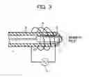 Fig. 04 - Method of securing acupuncture needle to insertion tube and acupuncture needle with insertion tube