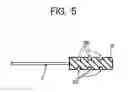 Fig. 06 - Method of securing acupuncture needle to insertion tube and acupuncture needle with insertion tube