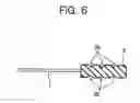 Fig. 07 - Method of securing acupuncture needle to insertion tube and acupuncture needle with insertion tube