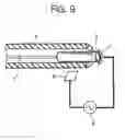 Fig. 10 - Method of securing acupuncture needle to insertion tube and acupuncture needle with insertion tube