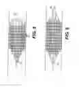 Fig. 05 - Embolic protection device