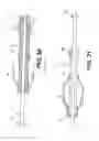 Fig. 13 - Embolic protection device