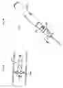 Fig. 13 - Wound closure devices and methods