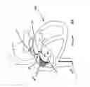 Fig. 16 - PATENT FORAMEN OVALE CLOSURE METHOD