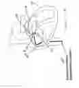 Fig. 18 - PATENT FORAMEN OVALE CLOSURE METHOD