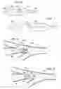 Fig. 03 - Apparatus and method for deployment of a bronchial obstruction device