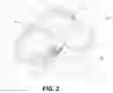 Fig. 03 - OVERMOLD FOR A MODULAR IMPLANTABLE MEDICAL DEVICE