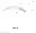 Fig. 11 - OVERMOLD FOR A MODULAR IMPLANTABLE MEDICAL DEVICE