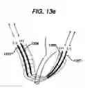 Fig. 18 - Conductive mesh for neurostimulation