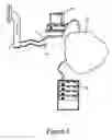 Fig. 06 - Therapy device and system and method for reducing harmful exposure to electromagnetic radiation