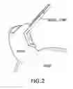 Fig. 03 - INTRAVASCULAR MEDICAL DEVICE