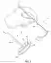 Fig. 04 - INTRAVASCULAR MEDICAL DEVICE
