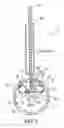 Fig. 06 - INTRAVASCULAR MEDICAL DEVICE