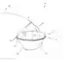 Fig. 01 - Apparatus and method for treating a regurgitant valve