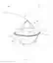Fig. 02 - Apparatus and method for treating a regurgitant valve