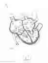 Fig. 10 - Apparatus and method for treating a regurgitant valve