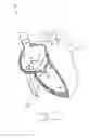 Fig. 19 - Apparatus and method for treating a regurgitant valve