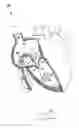 Fig. 20 - Apparatus and method for treating a regurgitant valve