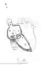 Fig. 23 - Apparatus and method for treating a regurgitant valve