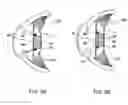 Fig. 04 - Accommodating lens assembly