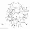 Fig. 02 - Facet joint replacement