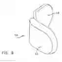 Fig. 11 - Facet joint replacement