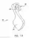 Fig. 15 - Facet joint replacement