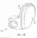 Fig. 18 - Facet joint replacement