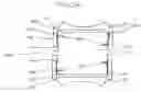 Fig. 13 - Intervertebral disc prosthesis