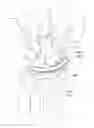 Fig. 01 - Methods and devices for resurfacing the wrist joint