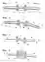 Fig. 02 - Joint prosthesis, use of such and a method for the application of a joint prosthesis