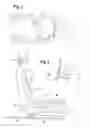 Fig. 02 - Occupant-protection system for vehicles and method for activating an occupant-protection system for vehicles