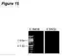 Fig. 22 - TAT-036 and methods of assessing and treating cancer