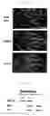 Fig. 08 - Mutant BDNF gene introducing knockin mouse