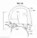 Fig. 02 - Head stabilizing system