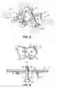Fig. 04 - LIFTING FIXTURE FOR CONCRETE STRUCTURES