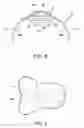 Fig. 04 - Treeless exercise saddle for racehorses