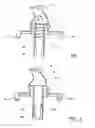 Fig. 04 - Filter assembly