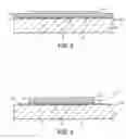 Fig. 04 - Thermal liquid flow sensor and method of forming same