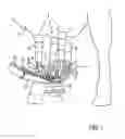 Fig. 02 - Milking device provided with cleansing means