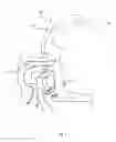 Fig. 05 - Valve system for underwater diving equipment