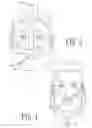 Fig. 03 - Method and System to Determine Nasal Resistance to Airflow