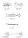 Fig. 16 - SYSTEMS AND METHODS FOR DELIVERING FLOW RESTRICTIVE ELEMENT TO AIRWAY IN LUNGS